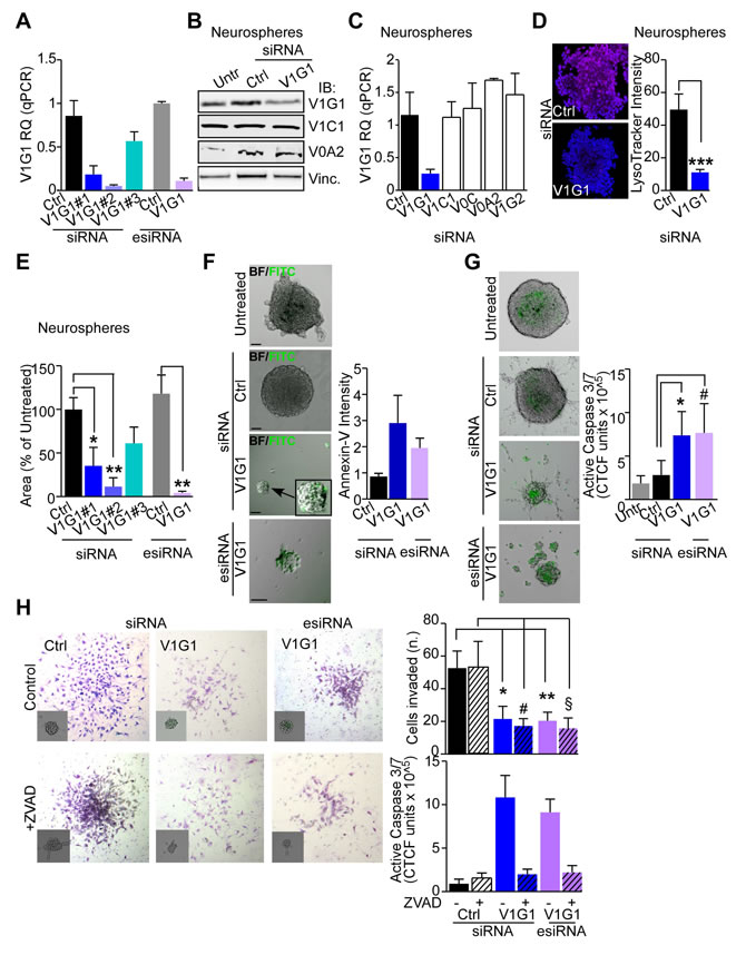 V-ATPase subunit G1 is central for GBM stem cell viability and invasive potential.