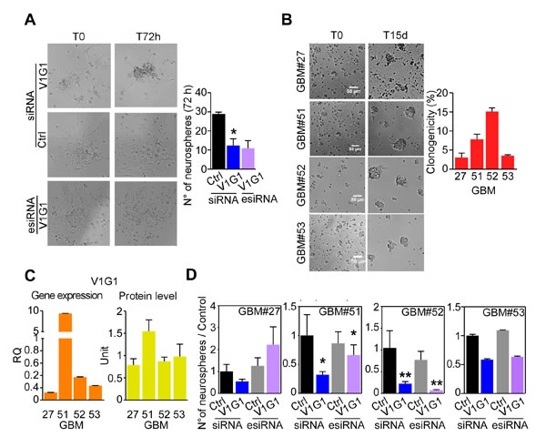 V-ATPase G1 levels are associated to clonogenicity of GBM neurospheres.