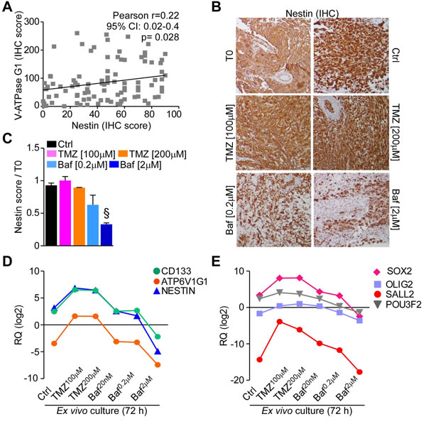 Bafilomycin A1 reduces stem cell factors expression in GBM organ cultures.