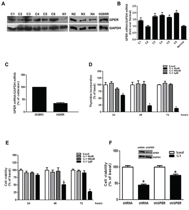 G-1 treatment decreases H295R cell growth in vitro.