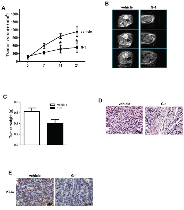 G-1 treatment decreases H295R cell growth in vivo.