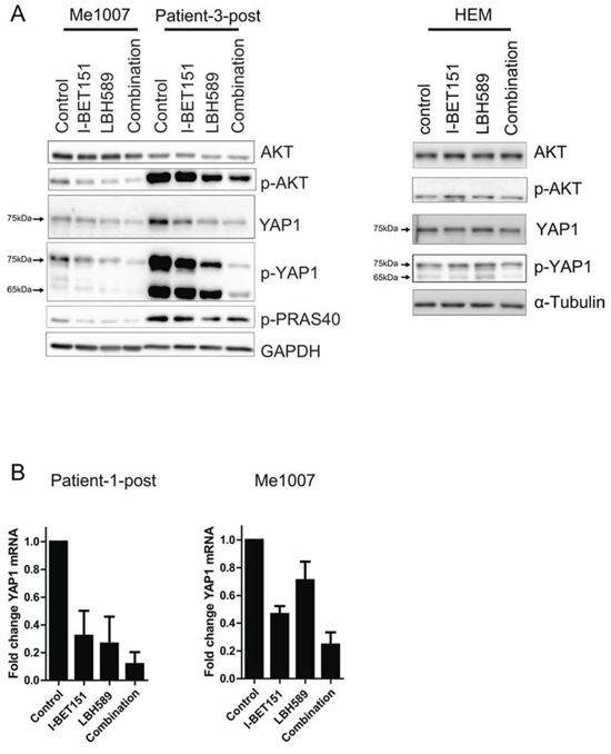 Co-treatment of I-BET151 and LBH589 downregulates AKT and Hippo/YAP signaling pathway.