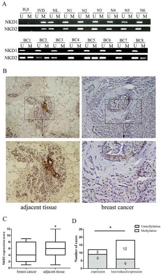 Representative results of NKD1 and NKD2 methylation and expression in primary breast cancer.