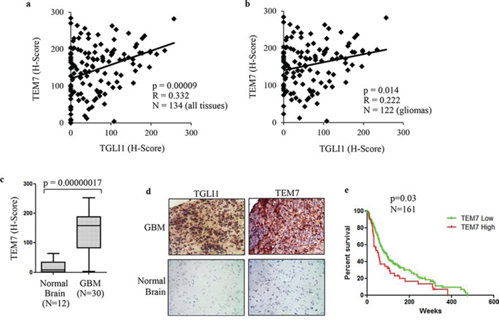 TGLI1 levels are positively associated with TEM7 levels in a cohort of patient gliomas.