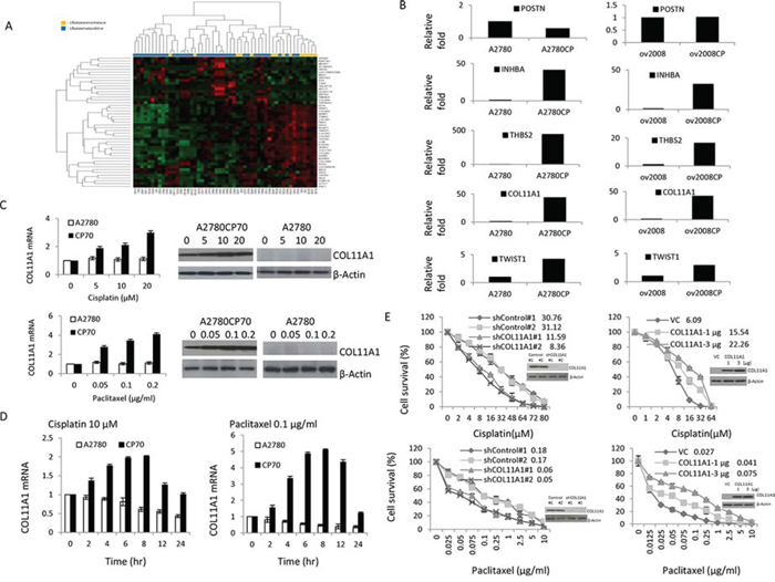 COL11A1 is involved in the regulation of cisplatin and paclitaxel responsiveness in chemoresistant ovarian cancer cells.