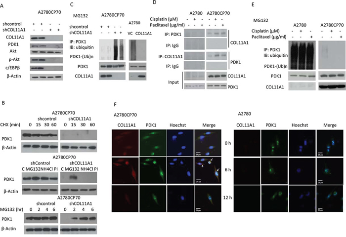 PDK1 protein is stabilized by COL11A1 through the increased binding of PDK1 to COL11A1 in chemoresistant ovarian cancer cells.