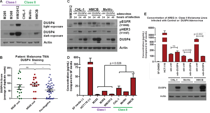 Lack of DUSP4 is a Potential Mechanism for ERBB Activation in Class II Melanomas.