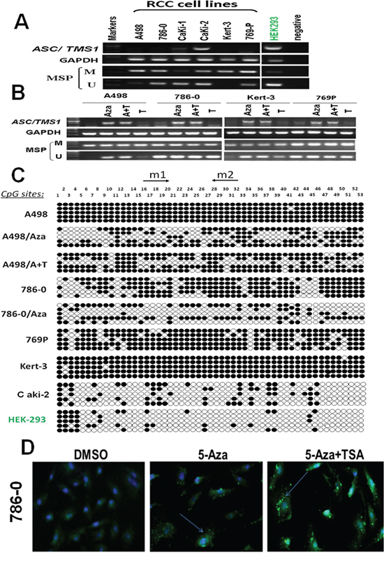 ASC/TMS1 inactivation by promoter hypermethylation in RCC cell lines.