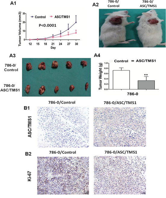 ASC/TMS1 inhibited growth of tumors derived from 786&#x2013;0 in vivo.