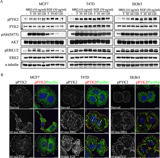 Phosphorylation and subcellular localization of PYK2 in EGF- and HRG-stimulated breast cancer cells.