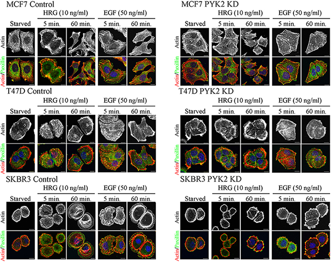 PYK2 depletion affects EGF/HRG-induced breast cancer cell spreading and actin cytoskeleton remodeling.