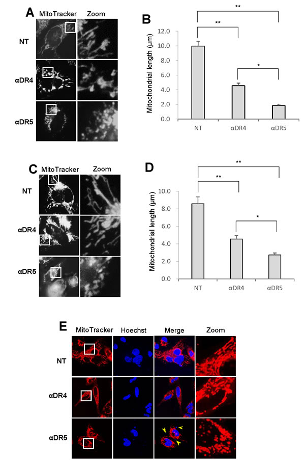 Mitochondrial fragmentation and clustering are specifically associated with apoptotic cell death.