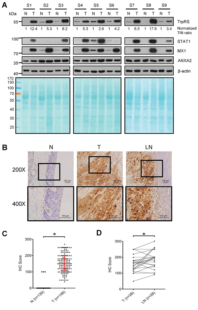 TrpRS is overexpressed in OSCC tissues.