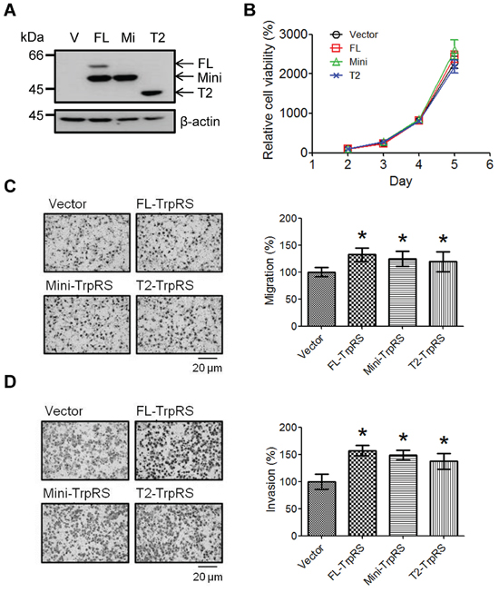 TrpRS overexpression promotes cell migration and invasion.