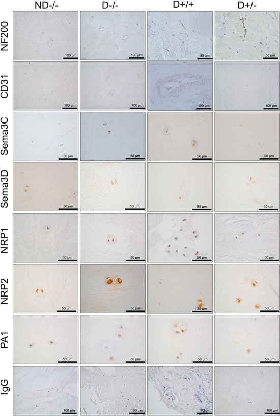 Immunopositivity of class 3 semaphorins and their receptors within the IVD.