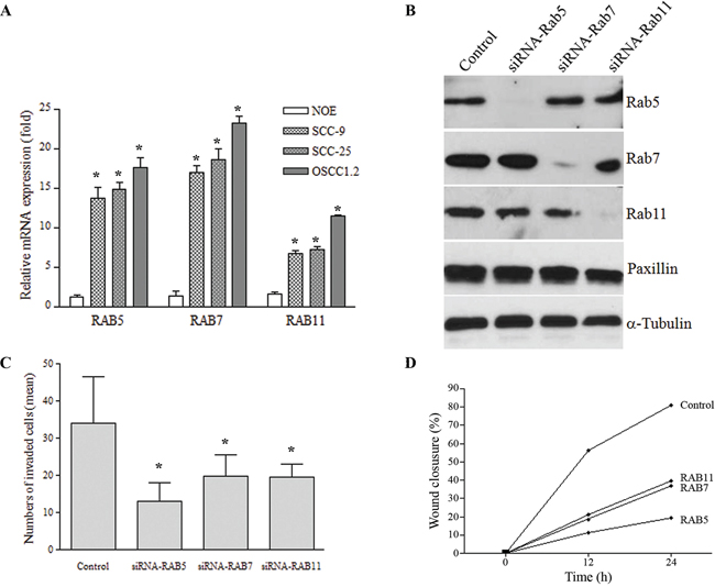 A. mRNA levels of RAB5, RAB7 and RAB11 estimated by qRT-PCR was elevated in a highly metastatic cell line (OSCC1.2) established from a poorly differentiated and metastatic human oral cancer (stage: T4N2b) with vascular, lymphatic and perineural invasion, as well as in the SCC-25 cell line while low expression was seen in normal oral epithelial (NOE) cells established from normal human tongue tissue (*P < 0.05).