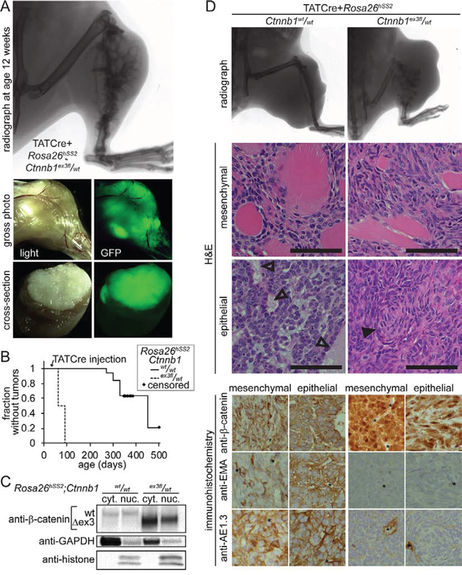 Initiation of tumors with injected TATCre enables comparison of SS18-SSX2-induced tumors with and with genetic stabilization of &#x03B2;-catenin.