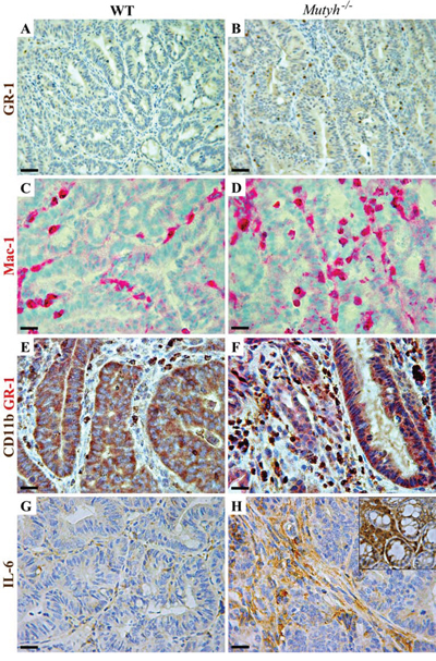 Myeloid cell infiltrate and IL6 expression in adenomas developed in AOM/DSS-treated wild-type and Mutyh&#x2212;/&#x2212; mice.