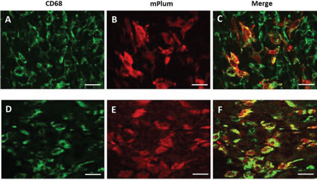 Immuno-histochemical identification of mPlum expressing cells in tumor environment.