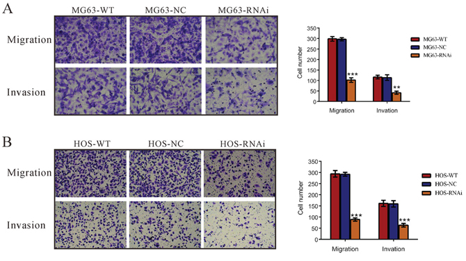 Silencing of TRIM66 inhibited cell migration and invasion in osteosarcoma cells.