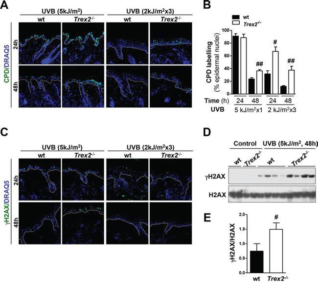 Loss of TREX2 triggers the highest accumulation of UVB-induced DNA damage in the skin.