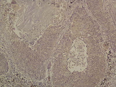 Immunohistochemistry for OLR1.