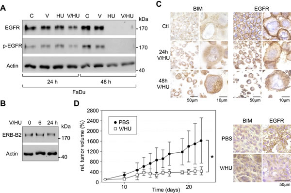 Effects of VPA/HU on the growth factor receptors EGFR and ERB-B2, and suppression of HNSCC tumor growth