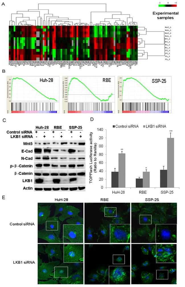 GSEA identified the enrichment of Wnt/&#x3b2;-catenin upon knockdown of LKB1 in ICC cells.