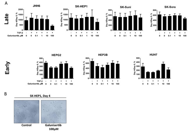 Antiproliferative and anti-invasive effects of galunisertib.