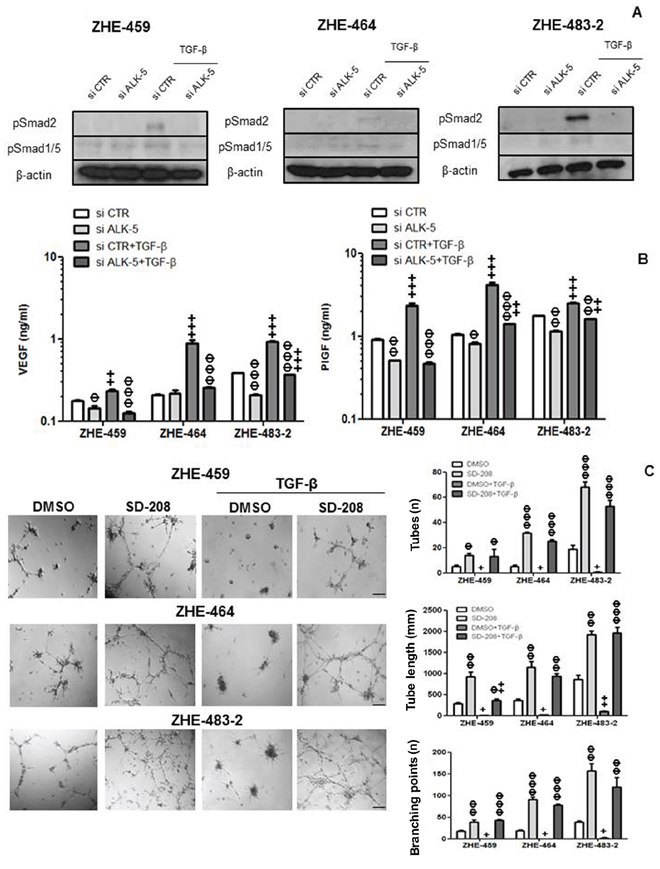 TGF-&#x03B2; control of VEGF release in glioblastoma-derived endothelial cells (GMEC).