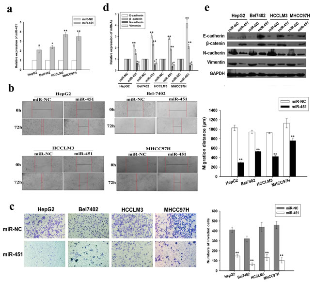 Re-expression of miR-451 negatively regulates HCC cell invasion and metastasis, as well as EMT process