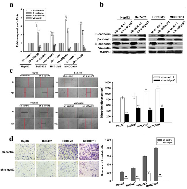 Effects of c-Myc downregulation on EMT, migration and invasion of HCC cells.