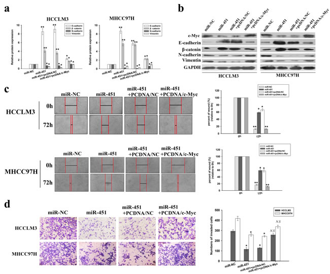 Overexpression of c-Myc reverses the effects of miR-451 upregulation on EMT, migration and invasion of HCC cells.