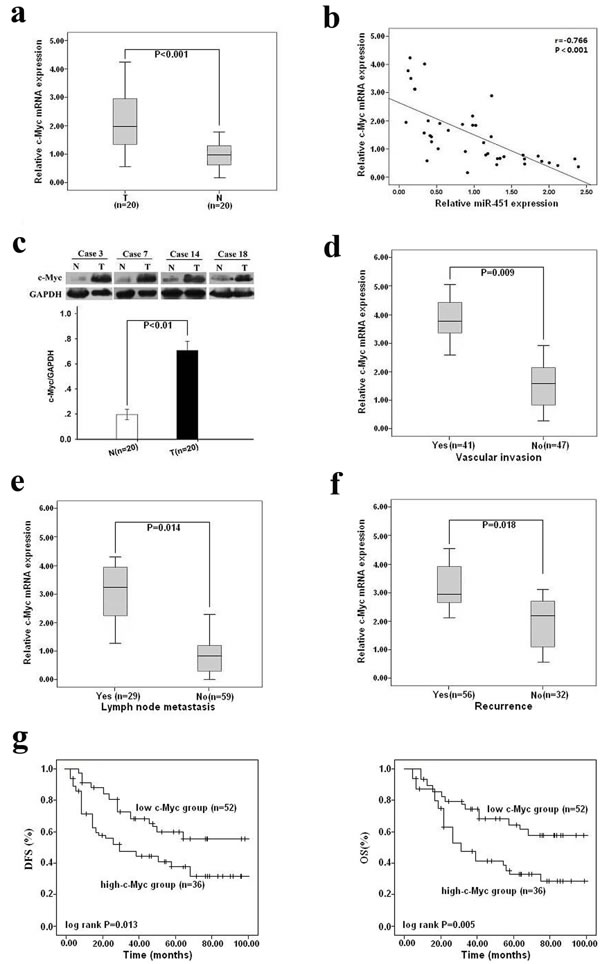 Upregulation of c-Myc in HCC tissues, inversely correlated with miR-451 expression, is associated with metastasis and poor survival of patients.