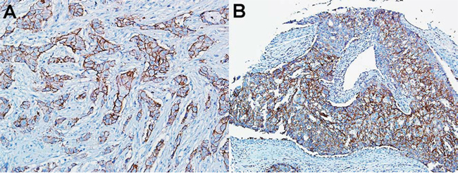 Immunohistology of TNBC patient specimens.