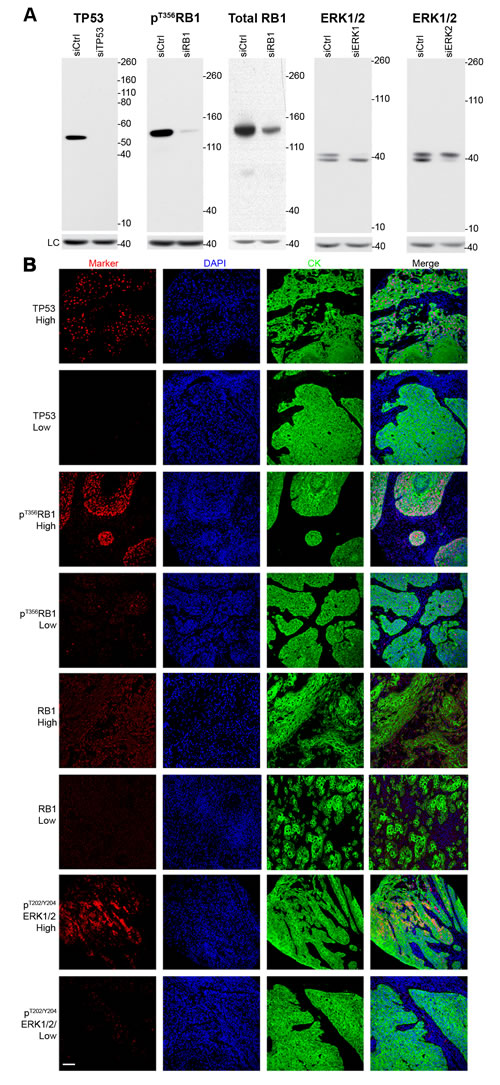 Validation of antibodies and immunofluorescence microscopy.