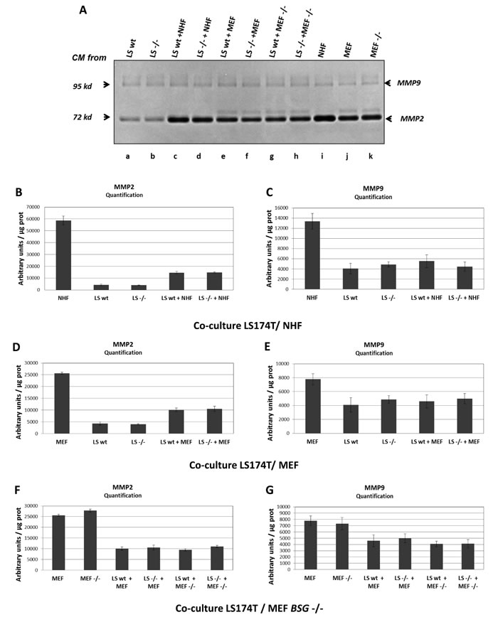 MMP2 and MMP9 expression in LS174T cells.