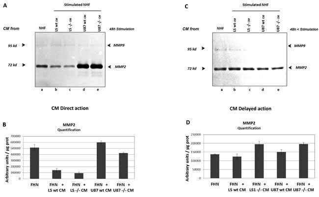 MMP2 and MMP9 expression by NHF stimulated by conditioned media (CM) from tumour cells.