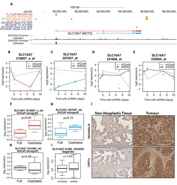 MCT2 expression persists in hormone-refractory disease and SLC16A7/MCT2 expression is linked with the ETS-related gene ERG.