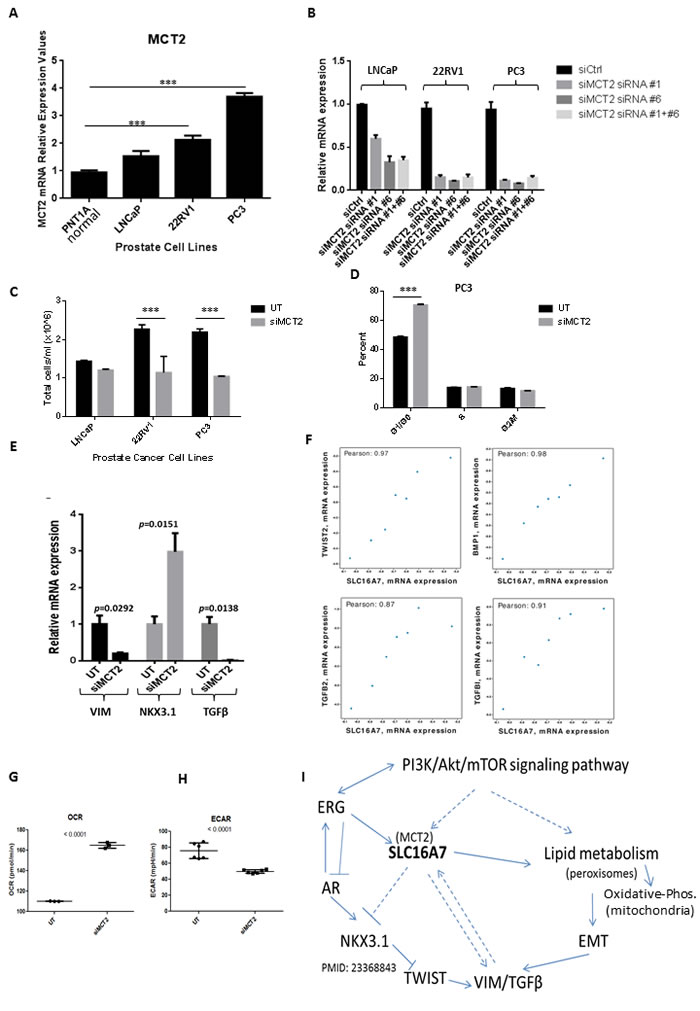 MCT2 knock down affects cells kinetics and is correlated with EMT gene expression in human PCa tumours.