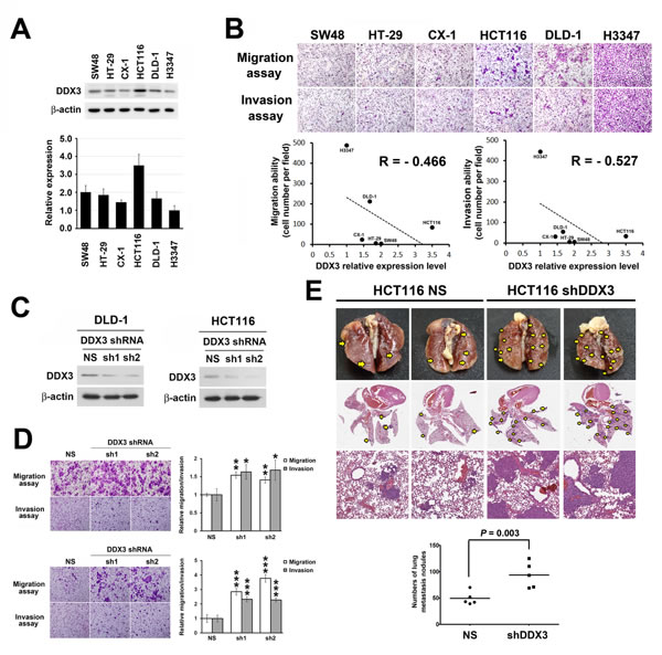 Repression of DDX3 expression resulted in increased cell migration and invasion in colon cancer cells and enhanced tumor metastasis