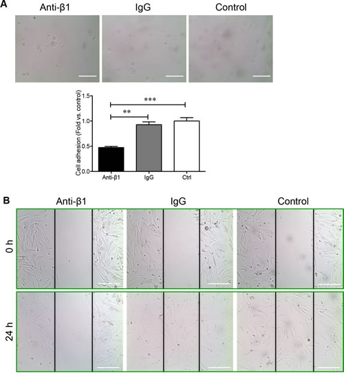 &#x3b2;1 integrin blockade reduces PaSC adhesion and migration on collagen I.