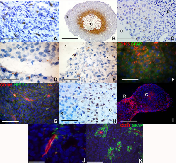 Vascular gene expression in putative brain tumor-derived endothelial cells within RCCS aggregates