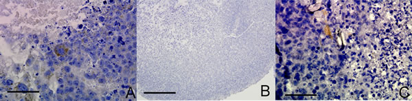 OCT4 overexpression in mouse NSC RCCS aggregates leads to CD105 expression.