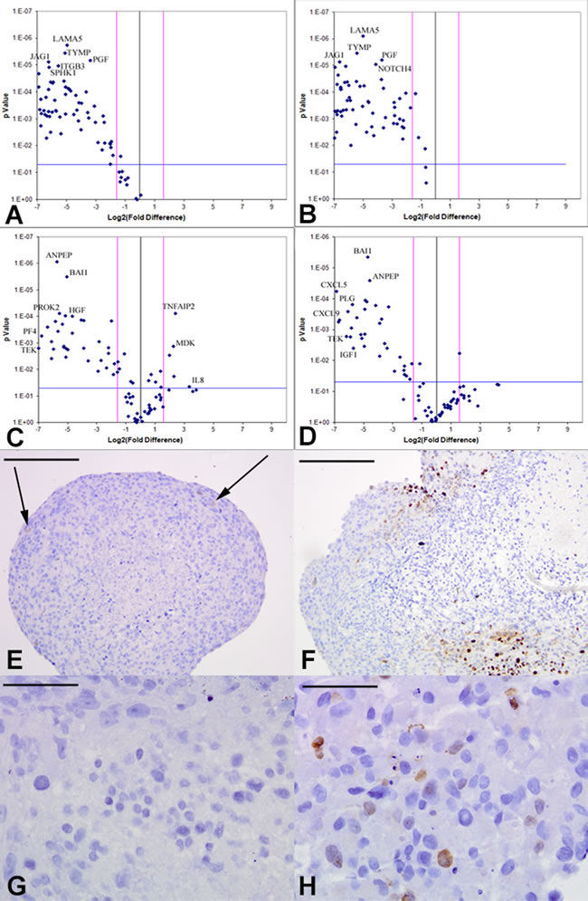 Downregulation of tumor-derived angiogenic response upon VEGF or FGFR inhibition