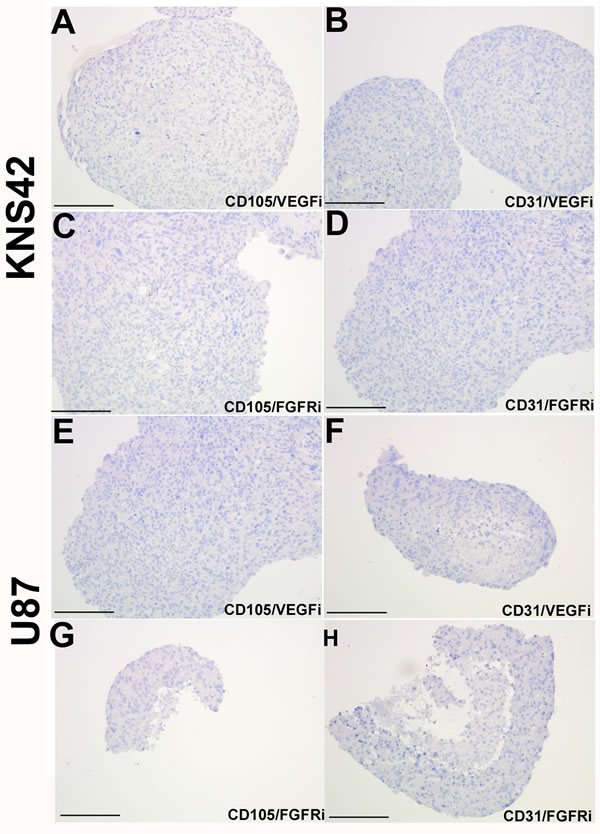 Loss of tumor-derived endothelial marker expression upon VEGF or FGFR inhibition