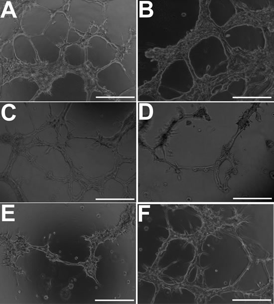 GBM cells develop morphological features of endothelial cells when cultured under endothelial-promoting conditions