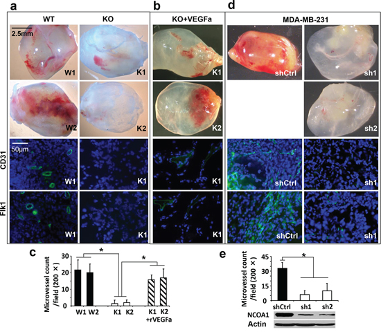In vivo Matrigel angiogenesis induced by mouse and human breast tumor cells with Ncoa1 knockout and NCOA1 knockdown, respectively.