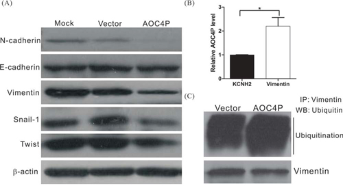AOC4P binds to vimentin and enhances vimentin degradation.