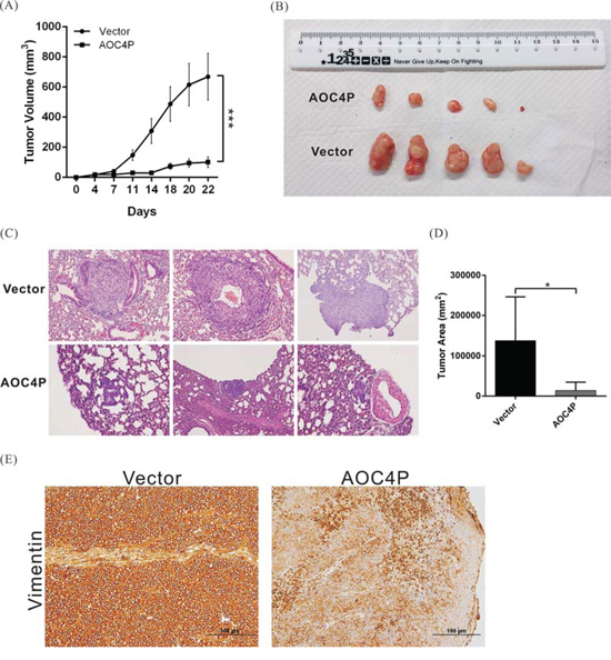 AOC4P inhibited HCC cell-based tumor growth and metastasis in vivo.